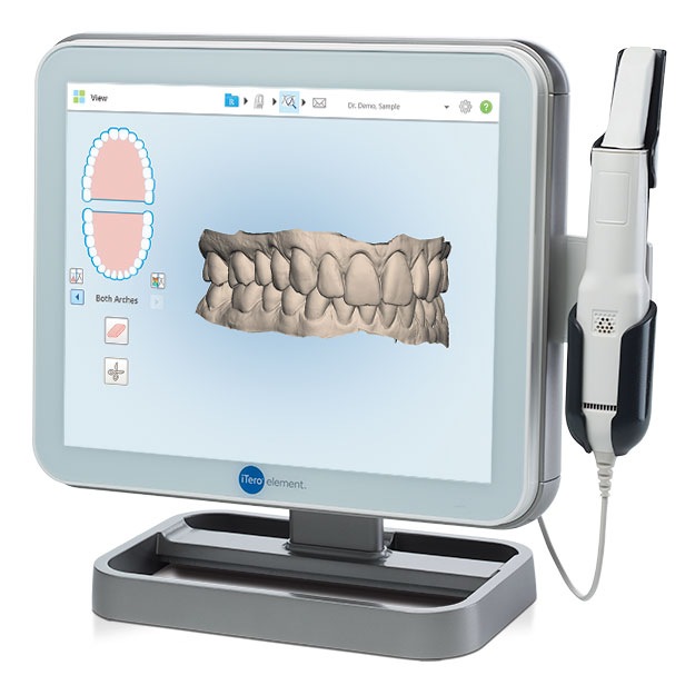 3D-Itero Scanner